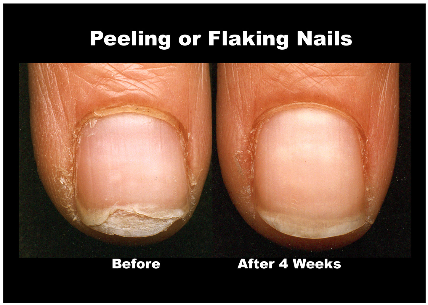 ProStrong Get Flexible Nail Strengthening Gel