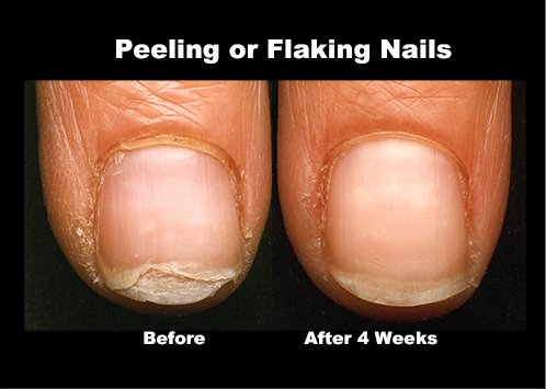 ProStrong ProAdvanced Triple Strength Nail Moisturizer with Peptides