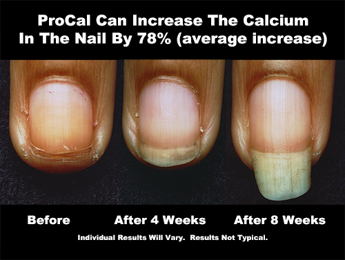 ProStrong ProCal Calcium Nail Supplement